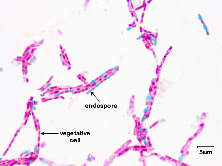 Photomicrograph of an endospore stain of <i>Bacillus megaterium</i> showing green endospores inside red vegetative cells.