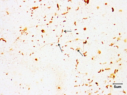 Photomicrograph of a flagella stain of a <i>Vibrio</i> species showing monotrichous arrangement of flagella.