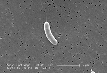 Scanning electron micrograph of a flagella stain of <i>Vibrio vulnificus</i> showing monotrichous arrangement of flagella.