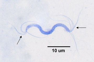 Photomicrograph of a flagella stain of a <i>Spitillum</i> species showing lophotrichous arrangement of flagella.