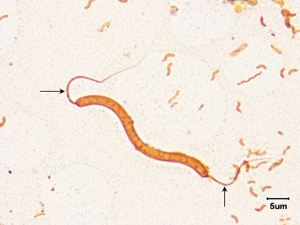 Photomicrograph of a flagella stain of a <i>Spirillum</i> species showing amphitrichous arrangement of flagella.