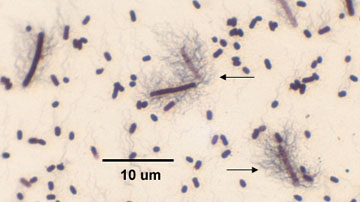 Photomicrograph of a flagella stain of a <i>Proteus</i> species showing peritrichous arrangement of flagella.