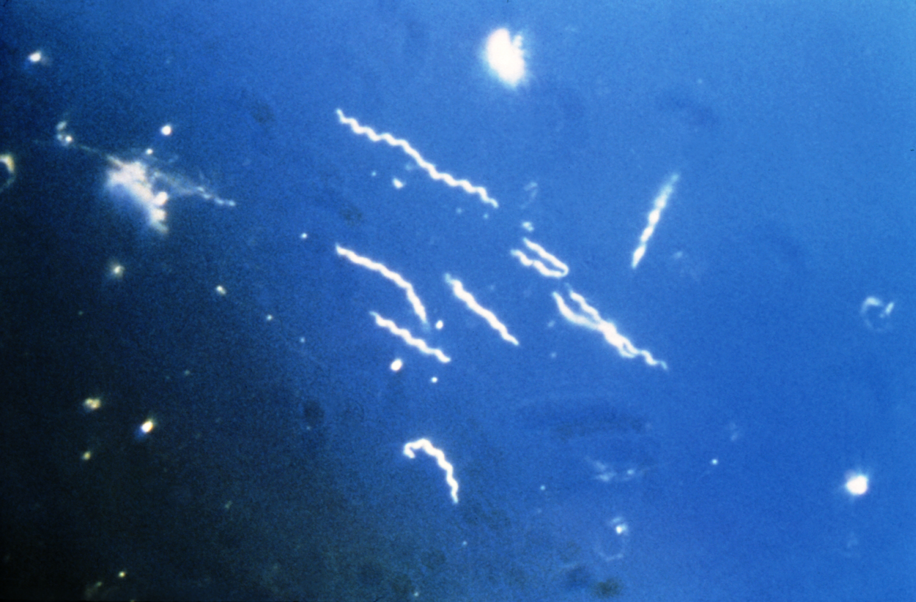 Photomicrograph of the spirochete <i>Borrelia burgdorferi</i> as seen using darkfield microscopy.