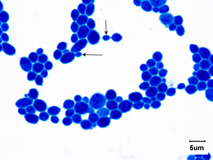 Photomicrograph of the yeast <i>Saccharomyces cerevisiae</i> showing budding.