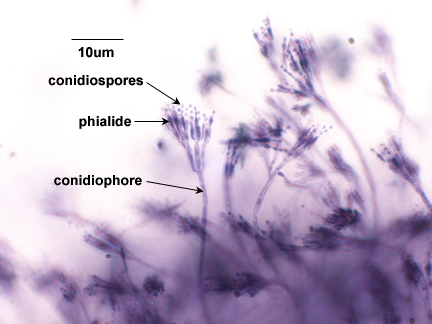Photomicrograph showing conidiospores on phialides of the mold <EM>Penicillium</EM>.