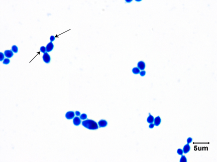 Photomicrograph of a direct stain of <i>Candida albicans</i> showing budding yeast.