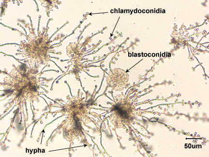 Photomicrograph of <i>Candida albicans</i> growing on rice extract agar and showing hyphae, blastoconidia, and chlamydoconidia.