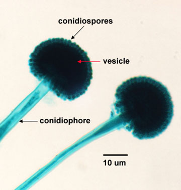 Photomicrograph of conidiospores of <EM>Aspergillus niger</EM>.