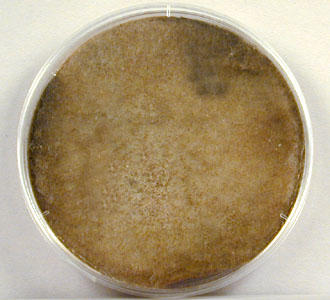 Photograph of <i>Rhizopus</i> growing on Saboraud dextrose agar.
