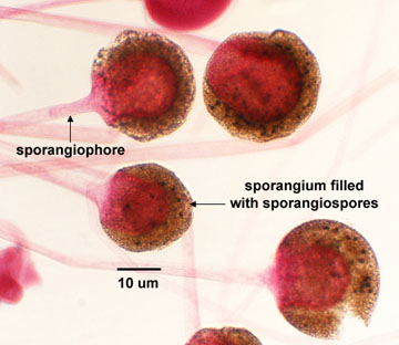Photomicrograph of sporangiospores of <EM>Rhizopus</EM> within a sporangium.