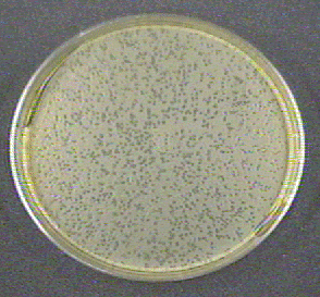 Photograph of a plate culture of <I>Escherichia coli</i> showing numerous plaques.