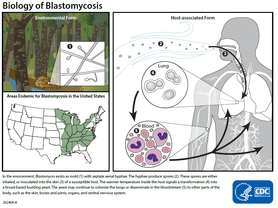Life cycle of <i>Blastomyces</i>.