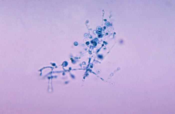 Photomicrograph of the mold form of <em>Blastomyces dermatitidis</em> with hyphae and conidiospores.