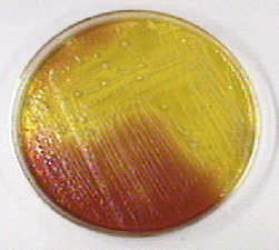 E. coli on XLD agar