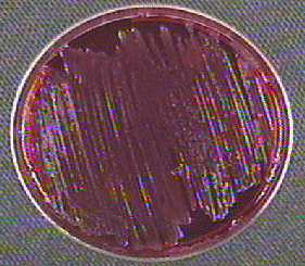Shigella on XLD agar