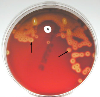 Photomicrograph of a blood agar plate inoculated with <i>Streptococcus pyogenes</i> and showing beta hemolysis and inhibition by the bacitracin in the Taxo A disk.
