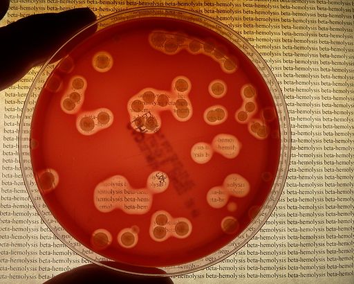 Dtreptococcus pyogenes showing beta hemolysis on blood agar
