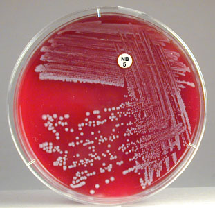 Photograph showing gamma reaction (no hemolysis) on blood agar.