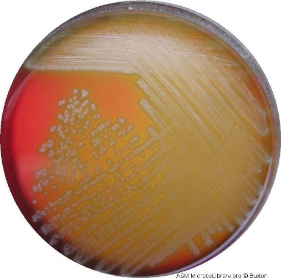 Photograph of a blood agar plate showing alpha hemolysis.