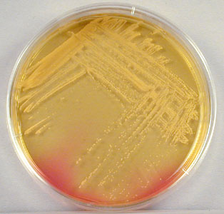 Photograph of <EM>Staphylooccus aureus</EM> growing on mannitol salt agar and fermenting mannitol.