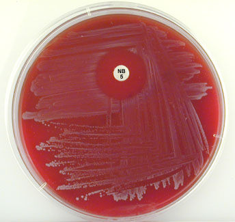 Photograph of <EM>Staphylococcus epidermidis</EM> growing on blood agar showing no pigment, gamma reaction (no hemolysis) and sensitivity to the novobiocin in the Taxo NB disk.