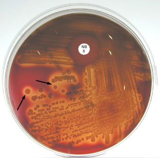 Photograph of <EM><em>Staphylococcus aureus</em></EM> growing on blood agar showing gold pigment, beta hemolysis and sensitivity to the novobiocin in the Taxo NB disk.