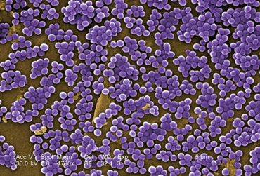 Scanning electron micrograph of Methicillin-Resistant <em><em>Staphylococcus aureus</em></em> (MRSA) showing cocci in irregular grape-like clusters.