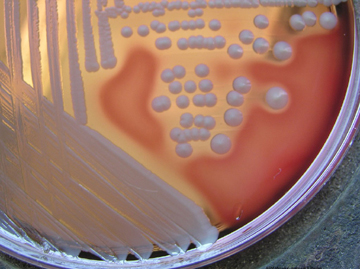 Photograph of <EM><em>Staphylococcus aureus</em></EM> growing on blood agar showing no pigment and beta hemolysis