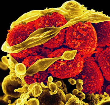 Scanning Electron Micrograph of Methicillin-Resistant <em><em>Staphylococcus aureus</em></em> killing an immune cell.