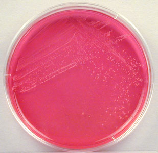 Photograph of <EM>Staphylooccus epidermidis</EM> growing on mannitol salt agar and not fermenting mannitol.