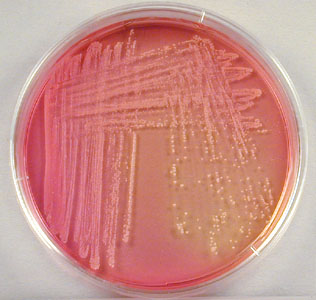 Photograph of <EM>Staphylooccus saprophyticus</EM> growing on mannitol salt agar and weakly fermenting mannitol.