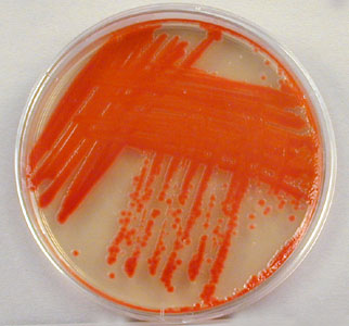 Photograph of a TSA plate culture of <i>Serratia marcescens</i> showing its red, water insoluble pigment.