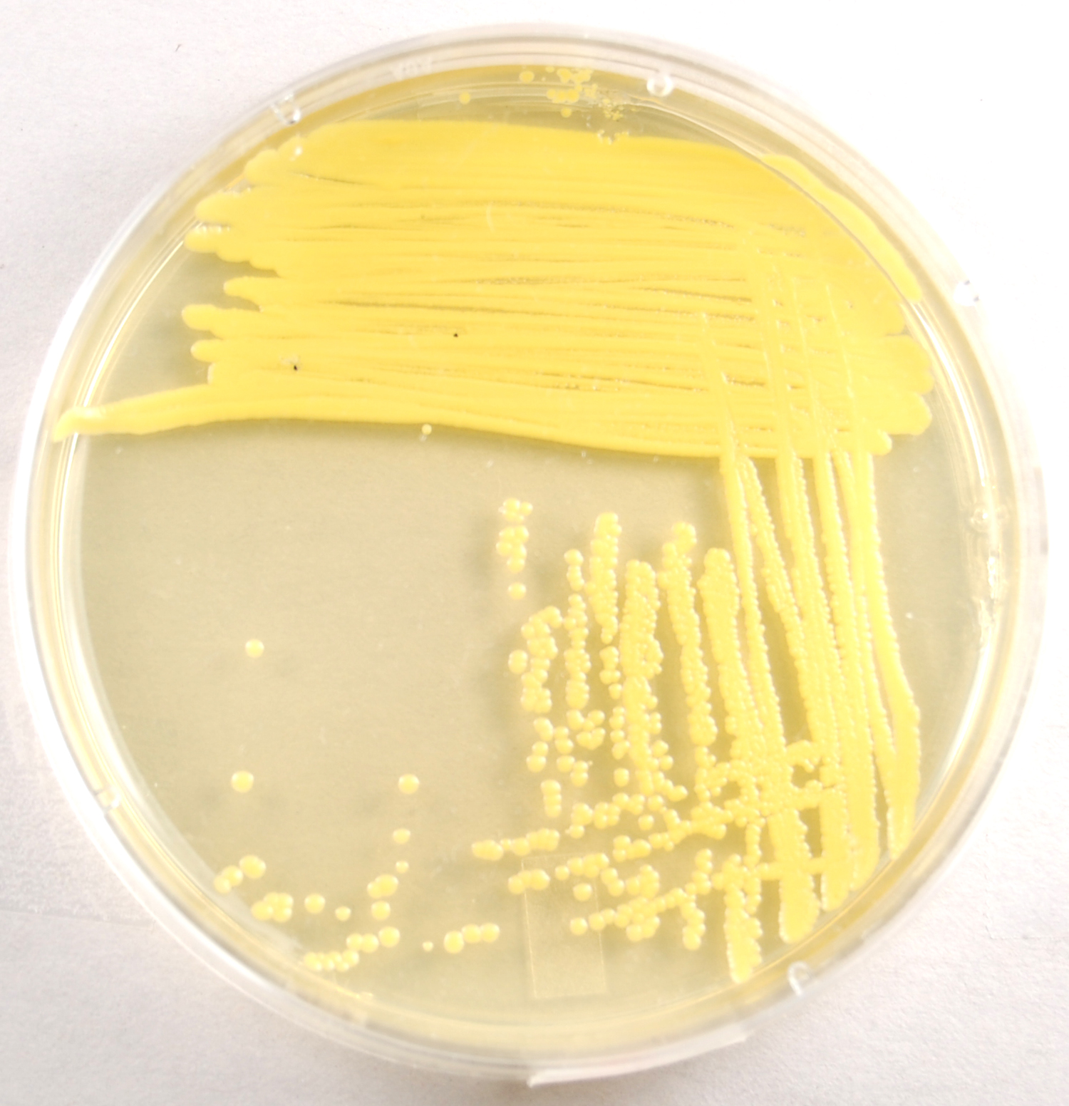 Photograph of a TSA plate culture of <i>Micrococcus luteus</i> showing its yellow, water insoluble pigment.