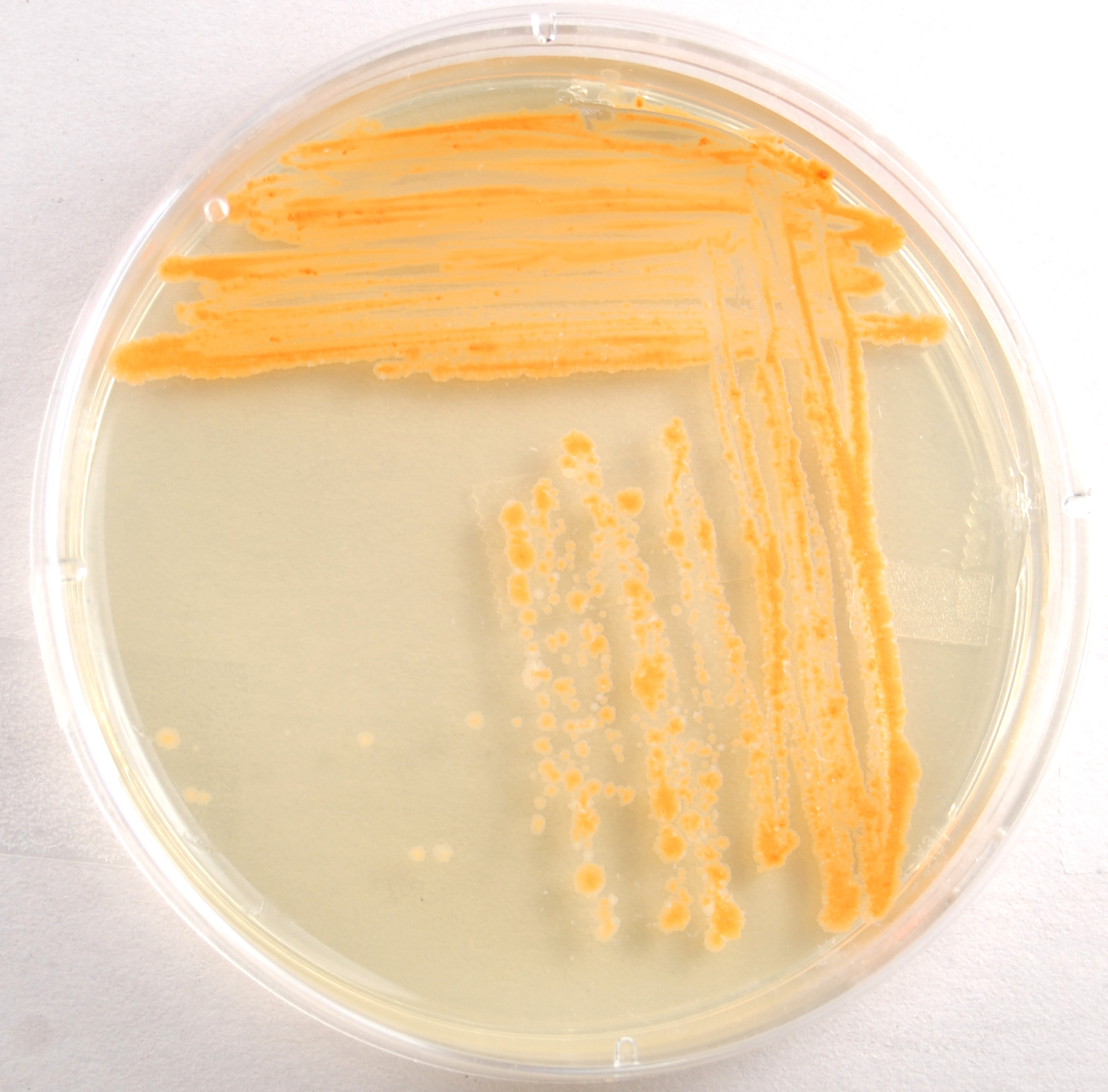 Photograph of a TSA plate culture of <i>Mycobacterium phlei</i> showing its orange, water insoluble pigment.