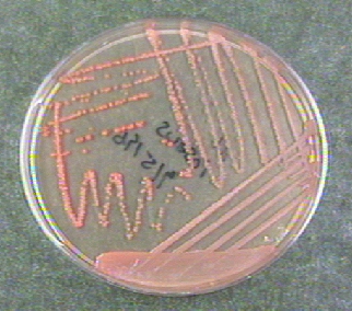 Photograph of a TSA plate culture of <i>Micrococcus roseus</i> showing its pink rose colored, water insoluble pigment.