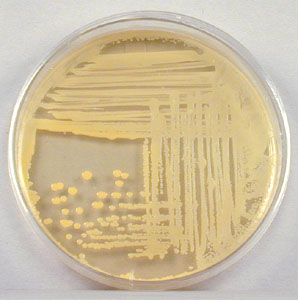 Photograph of a TSA plate culture of <i>Staphylococcus aureus</i> showing its gold, water insoluble pigment.