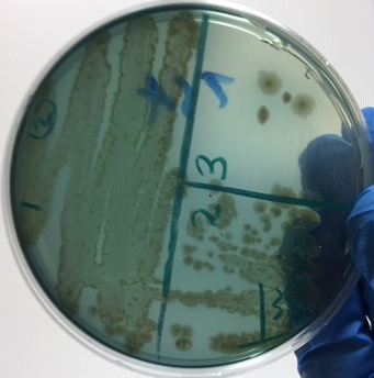 Photograph of a TSA plate culture of <i>Pseudomonas aeruginosa</i> showing its green, water soluble pigment.