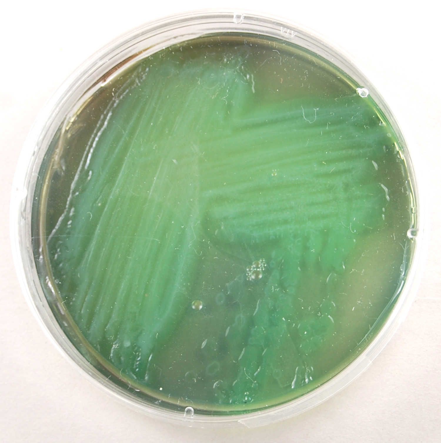 Photograph of a TSA plate culture of <i>Pseudomonas aeruginosa</i> showing its green, water soluble pigment.