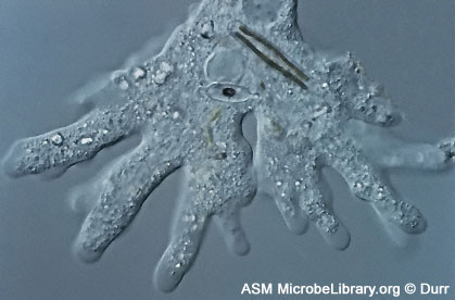 amoeba proteus.jpg