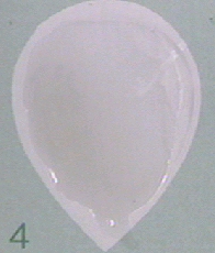 Photograph of a negative RPR test for syphilis showing no clumping of carbon particles.