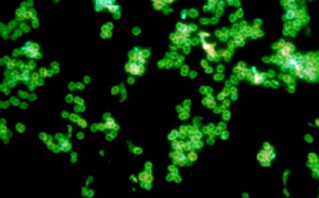 Photomicrograph of a positive direct fluorescent antibody test for <i>Neisseria gonorrhoeae</i> showing fluorescing diplococci.