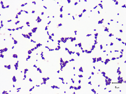 A photomicrograph of <i>Staphylococcus aureus</i>, taken with oil immersion microscopy, showing numerous staphylococcus arrangements of cocci.