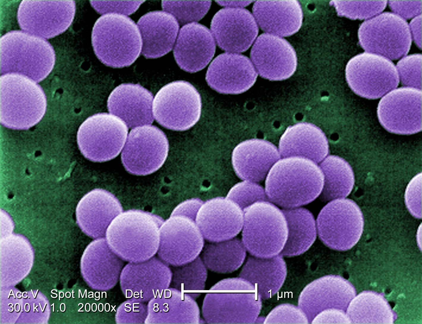 Scanning electron micrograph of <i>Staphylococcus aureus</i> showing staphylococcus arrangements.