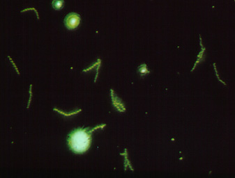 Photomicrograph of a positive FTA test for syphilis showing fluorescing <I>Treponema pallidum</I>.