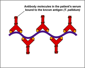 Illustration of an FTA test for syphilis showing antibodies against <I>Treponema pallidum</I> in the patient's serum, binding to the spirochete.