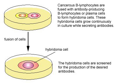 Illustretion of monoclonal antibody production, step 2. Fusing antibody B-lymphocytes with cancerous B-lymphocytes to produce hybridoma cells.