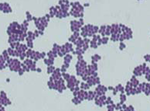 A micrograph shows purple circles in random clusters.