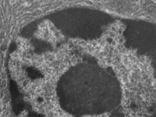 A micrograph of a portion of an oval cell. In the center is a darker spherical structure.