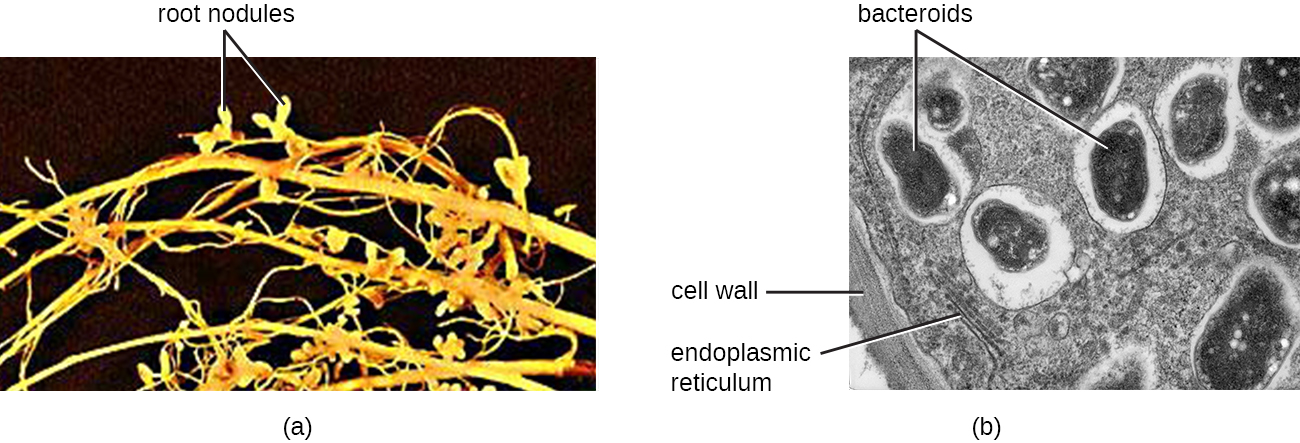 A) foto de raíces con pequeños nódulos etiquetados nódulos radiculares. Micrografía de un nódulo radicular. Una pared celular gruesa está en el exterior. Las líneas del interior están etiquetadas con retículo endoplásmico. Los óvalos grandes en estructuras claras están etiquetados como bacteroides.