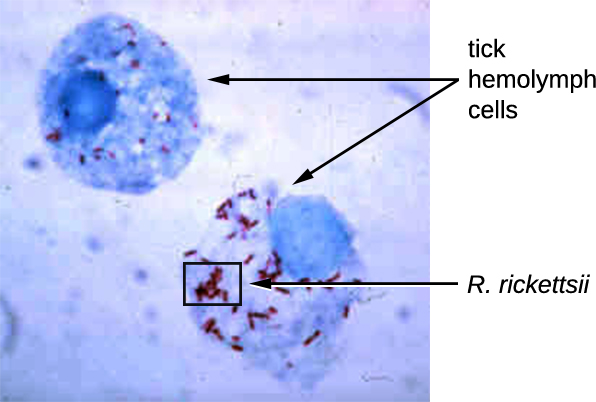 Micrografía de células azules marcadas con hemolinfa de garrapatas. Dentro de estas células se encuentran pequeños glóbulos rojos etiquetados como R. rickettsia.